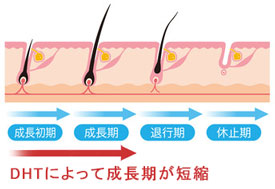 ヘアサイクルの短縮