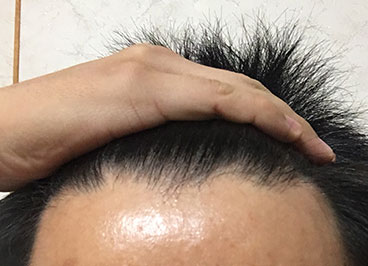 生え際のラインがしっかりしている男性